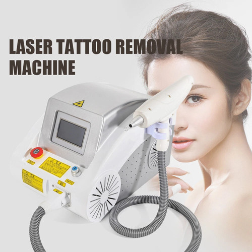 Yag switch tattoo - nd,
