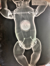 X RAY PLATE dating from 1962 , of my Doll Kim taken at the  Warneford Hospital
