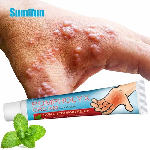 New sweat herpes treatment - herpes,