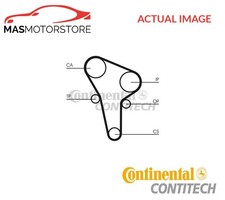 TIMING BELT / CAM BELT KIT