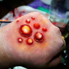 Boils #2 disease infection, plague wound! Deep & detailed latex scar prosthetic