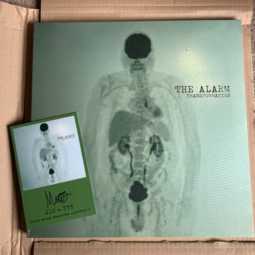 The alarm transformation - the,