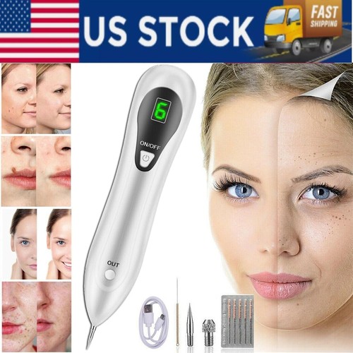 Electric laser plasma pen - electric, mole