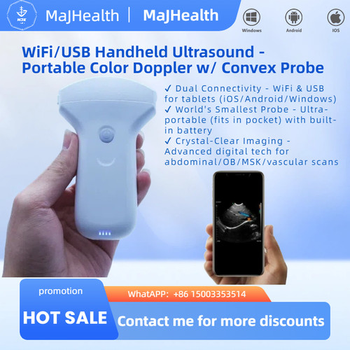 Wifi usb handheld ultrasound - handheld,