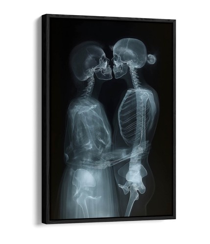 Ray image couple - image, of