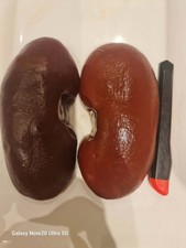 kidneys props for professional