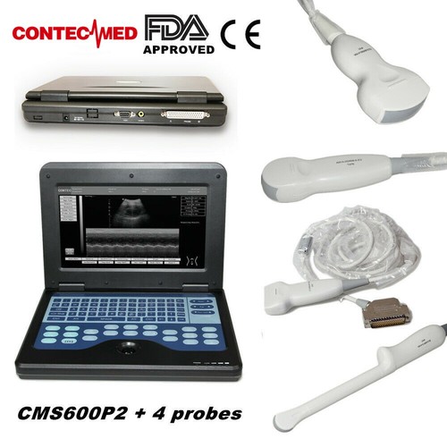 Portable ultrasound scanner - portable,