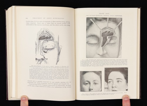 Antique medical book - antique,