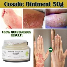 Coal Tar Cream 1.7oz - for Skin & Scalp Psoriasis - Coaltar 6% Salicylic Acid 3%