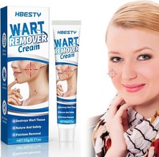 Wart Removal Cream 20gSkin Tag