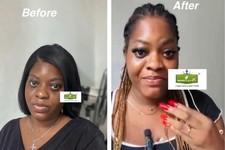 Skin lightening face - skin,