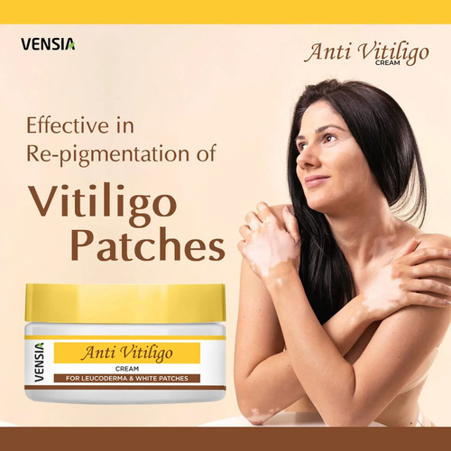 Vensia anti vitiligo cream - vensia,