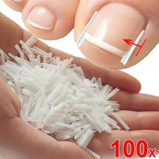 100Pcs Ingrown Toenail