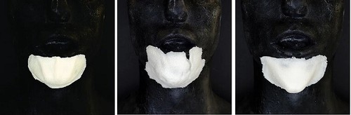 Prosthetic chin foam latex - chin,