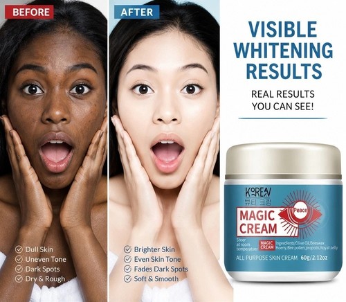 Kojic acid skin whitening - kojic,