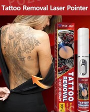 Tattoo laser removal, suitable