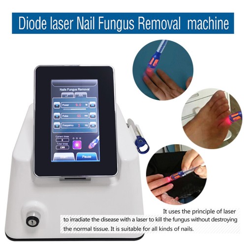 Professional 980nm diode - , laser