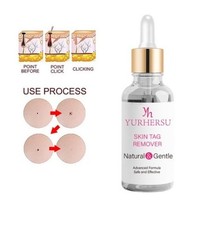 Skin Tag Remover Treatment Liquid - Neck, Eyelids etc Warts Moles