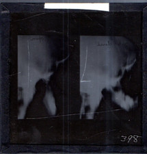 Vintage glass Magic Lantern slide - Human Skull : old medical x-ray osteology