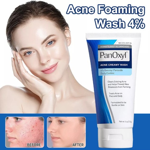 Acne foaming wash - foaming, body