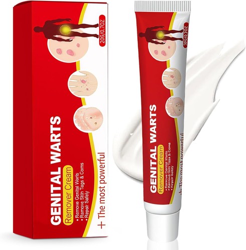 Strong skin tag remover - remover, cream