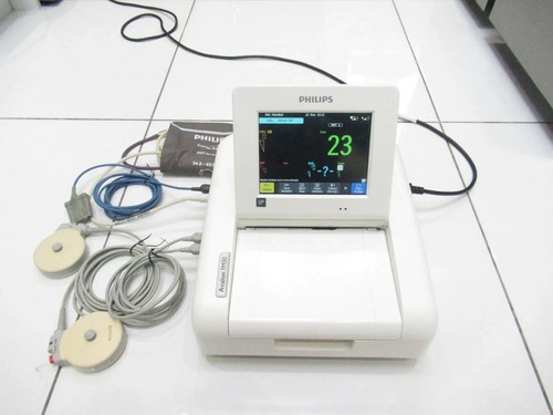Philips avalon fm30 toco - philips,
