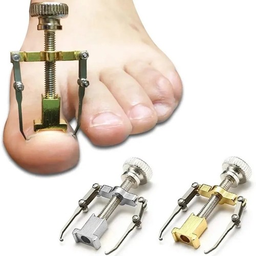 Toenail correction brace - correction,