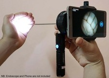 ClaraMed phone endoscope