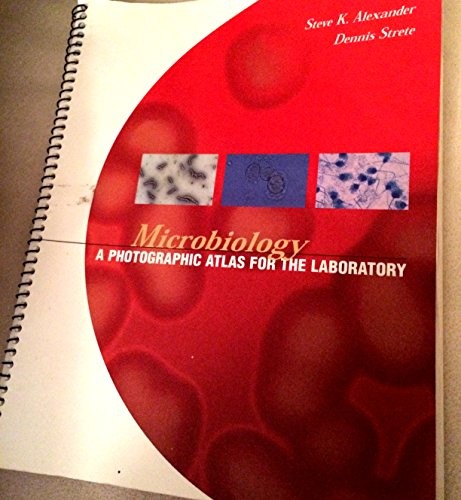 Microbiology photographic - microbiology:,