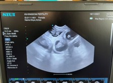 SIUI Apogee1000 Ultrasound scanner dogs veterinary with carry case Amazing scans