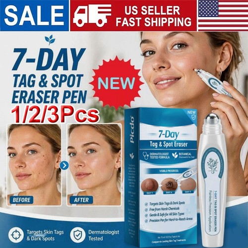 Day tag and spot remover - day,