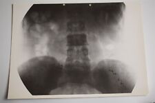 Large Colon X-Ray Photo Of 1930 France #1 Ledoux Lebard
