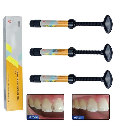Teeth resin tooth - resin, repair