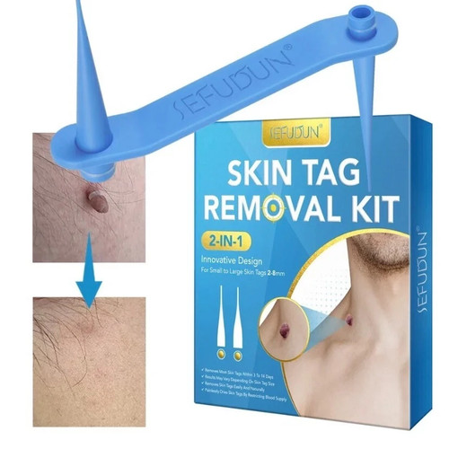 Micro auto skin tag - micro,
