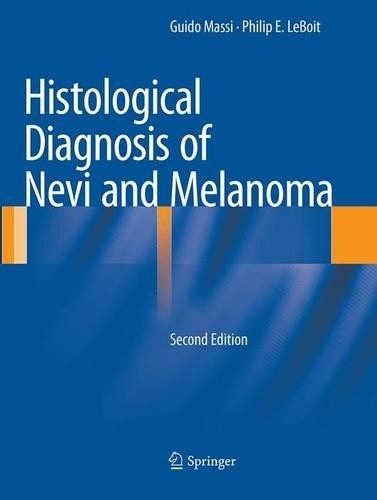 Histological diagnosis nevi - histological, of