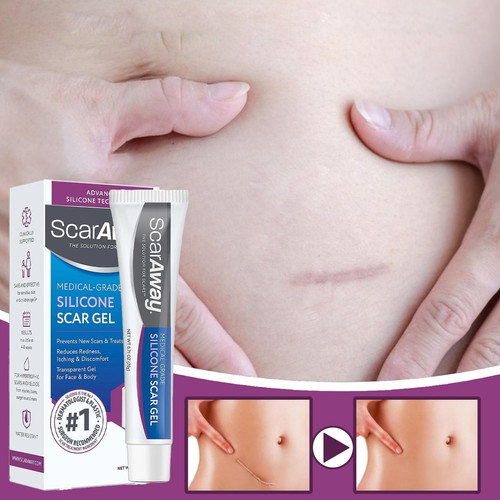Scar away medical grade - ,