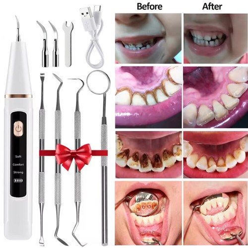 Ultrasonic tooth cleaner - tooth,