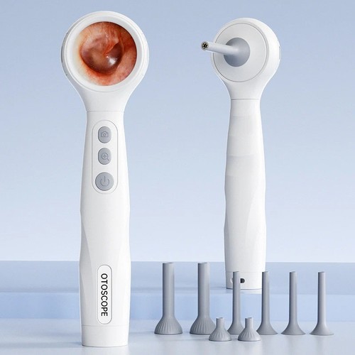 Visual otoscope camera - visual,