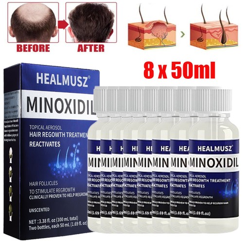 Pack minoxidil extra - 5%,