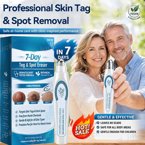 Skin tag remover roller - tag, pen