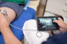 SONOSITE iVIZ HANDHELD