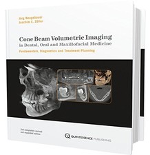 CONE BEAM VOLUMETRIC IMAGING