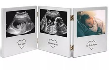 Baby Scan Photo Frame Double Hinged, Multi-Photo Picture Frame, VonHaus