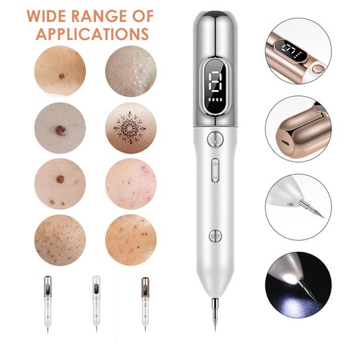 Laser plasma pen - pen, removal