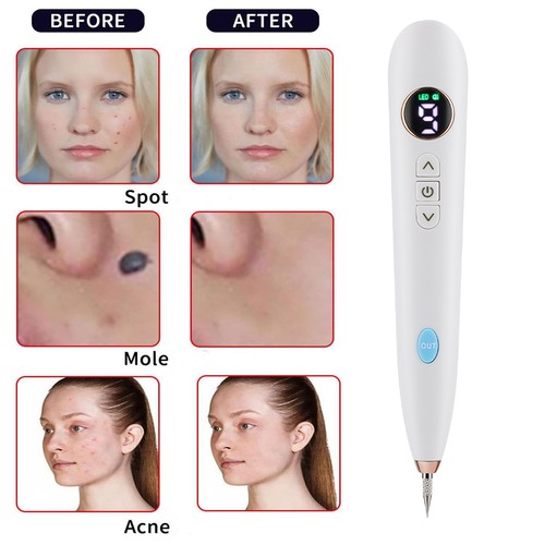 Level laser plasma pen mole - laser,