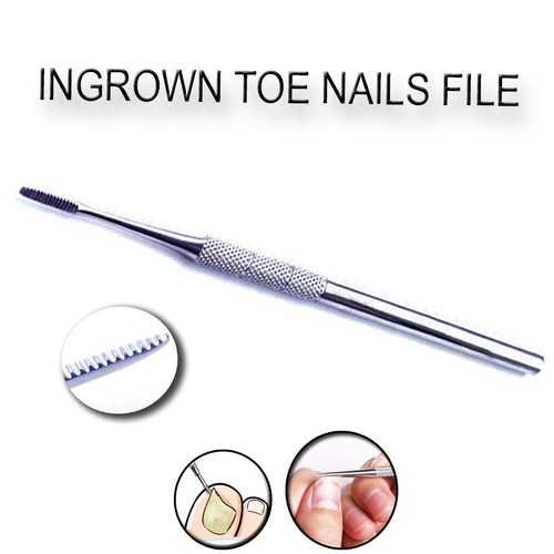Ingrown toe nail black - ingrown,