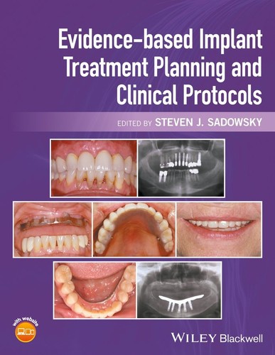 Evidence based implant - evidence–based,