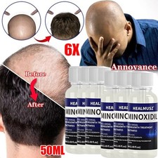 6pcs minoxidil hair - minoxidil,