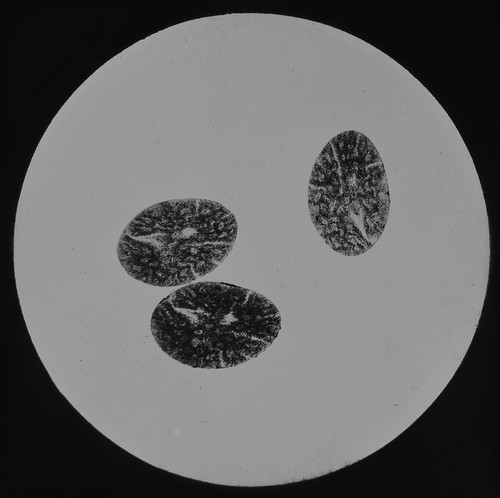 Microscope photo hair - hair, of