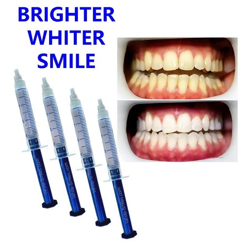 Very strong teeth - very, whitening